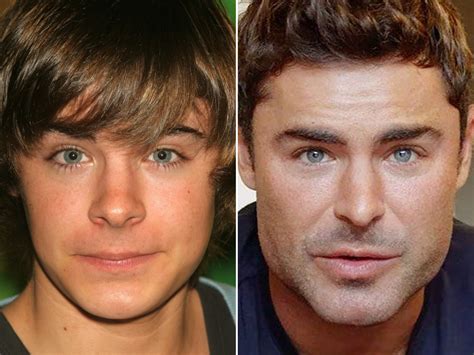 zac efron now|zac efron before after.